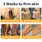 ⏰ LAST DAY 50% OFF👩‍⚕️Bee Venom Comprehensive Cream