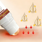 Rollerball-type essence for neck swelling and pain caused by forward head posture. Herbal application.