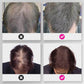 🔥BUY 2 GET 1 FREE💝Hair Thickening Hair Building Fiber Powder