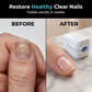 Portable Blue Light Nail Care Device