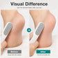 Dual-Sided Foot File Callus Remover