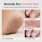 🔥50% OFF!!📢🧴 Moisturising Petroleum Jelly Stick – For Dry Hands & Feet 💧